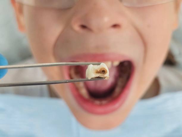 Best Weekend Emergency Dentist in Knightsen, CA
